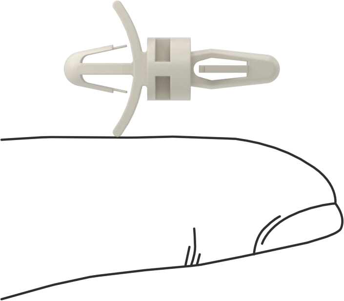 Yüksek Gerilimli Geçmeli Ayırıcılar, 1/4" Uzunluk