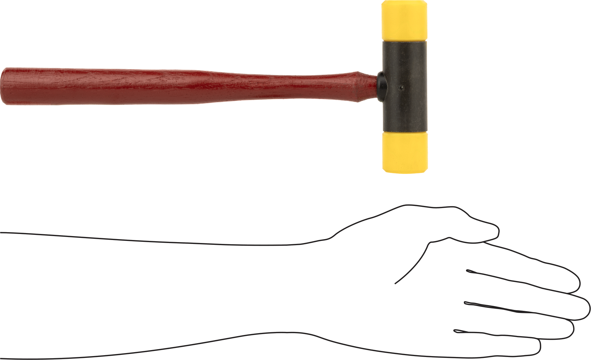 Polietilen Değiştirilebilir Yüzlü Tokmak, 1-1/4" Çapında Vidalı Yüz, Hickory Sap, 1 lbs.