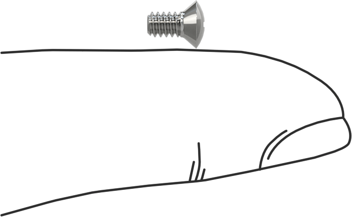 Krom Kaplı 18-8 Paslanmaz Çelik Phillips Oval Başlı Vidalar, 4-40 Diş Boyutu, 1/4" Uzunluk