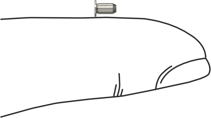 Sabit Pimler, A286 Paslanmaz Çelik, 2 mm Çap, 4 mm Uzunluk, Mpp-2mm-4